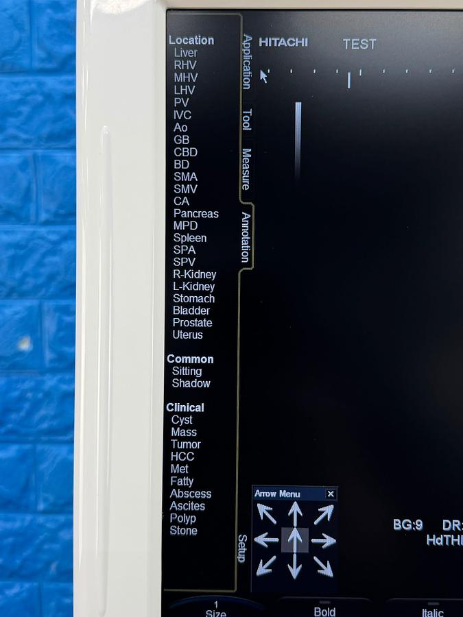 Used Hitachi HI Vision Avius Ultrasound  YOM: 2011   Probes  - EUP-C715 YOM: 2011 - EUP-V53W YOM: 2011 