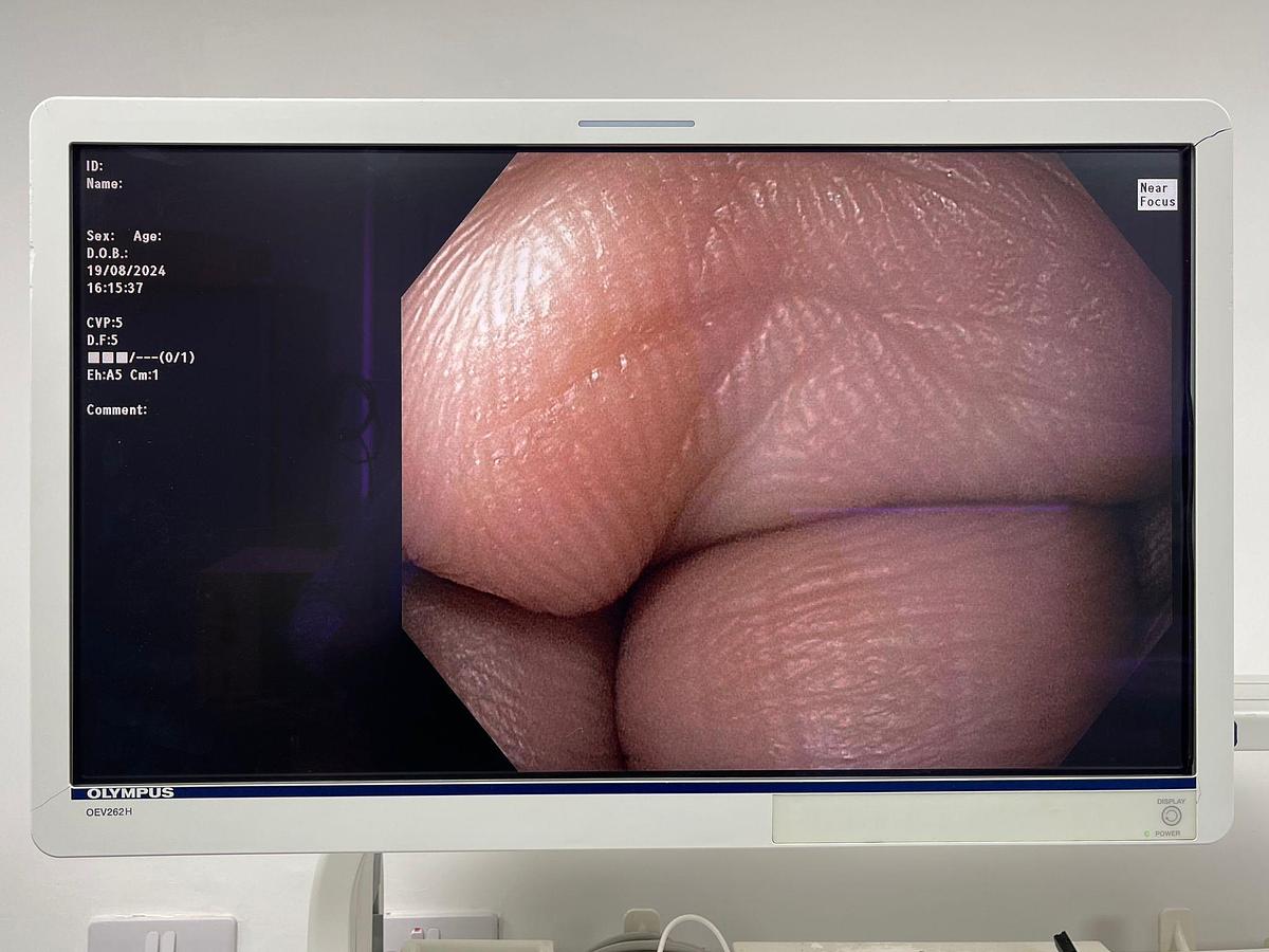 Used Olympus Scope Model: GIF- HQ190