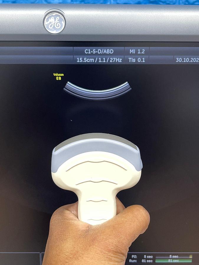 Used GE Voluson E8, YOM: 2011