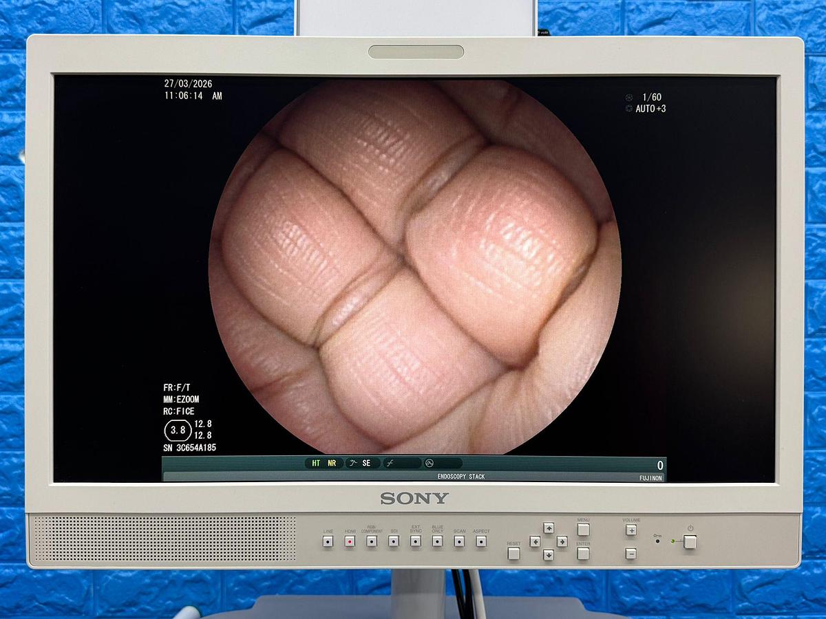 Used Fujinon Scope Model: EC-530FL 