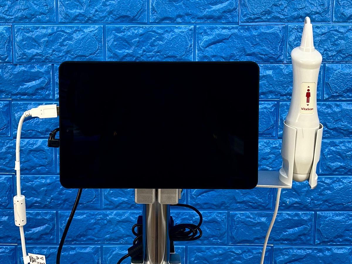 Used Vitacon VitaScan LT Urology Ultrasound With Vitascan V2 Probe.