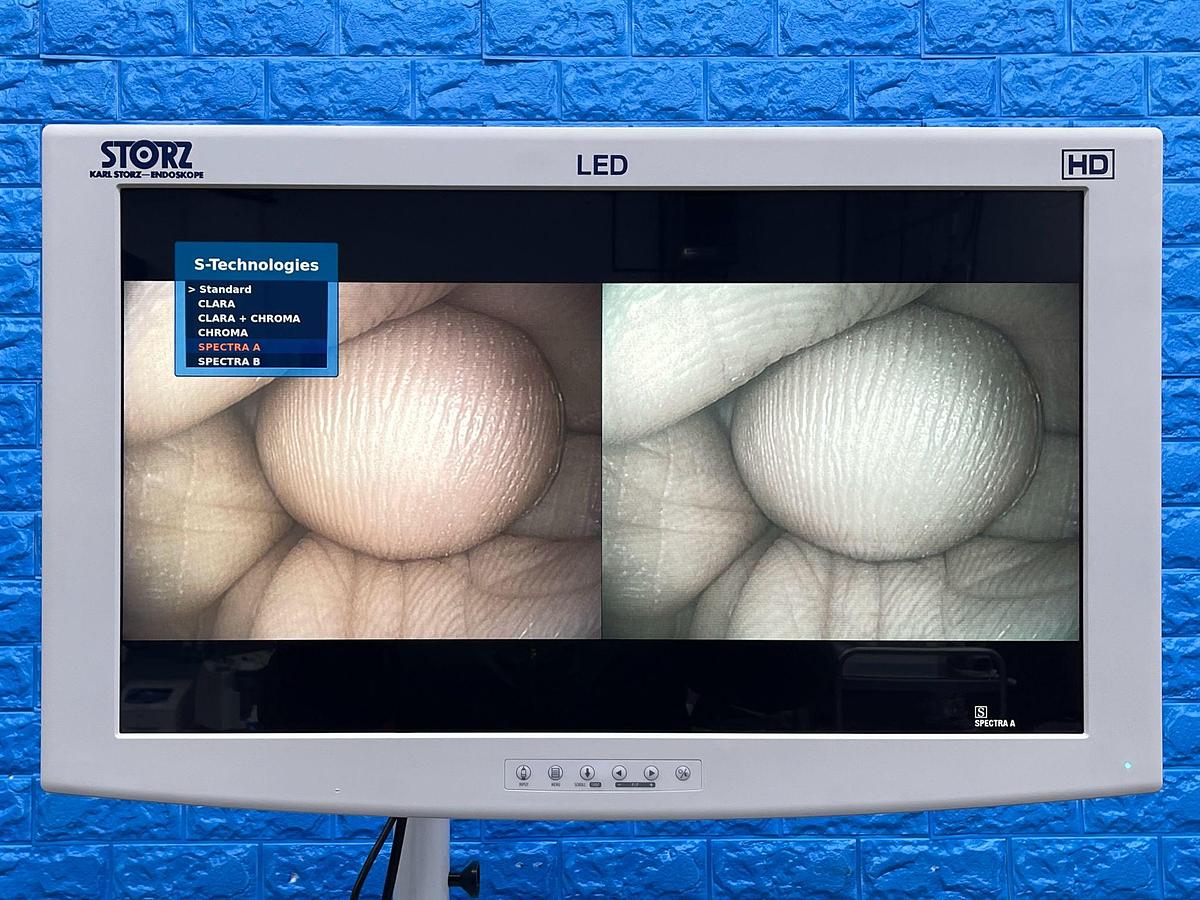 Used Karl Storz Scope Model: 13821 PKS