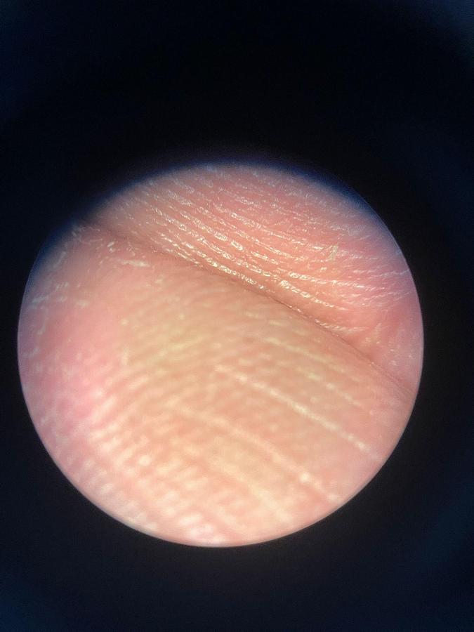 Used ZEISS S7 OPMI Movena Microscope YOM: 2009