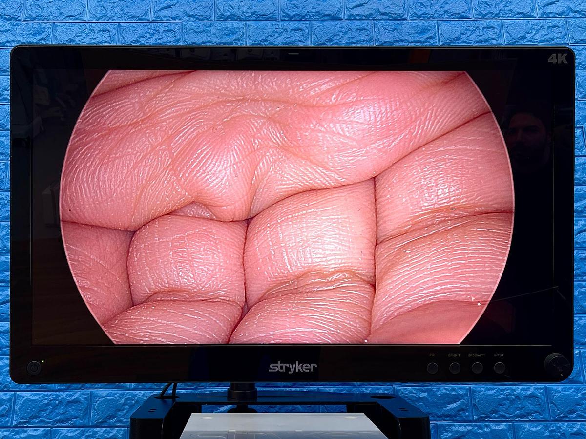 Used Stryker 1688 4K Tower