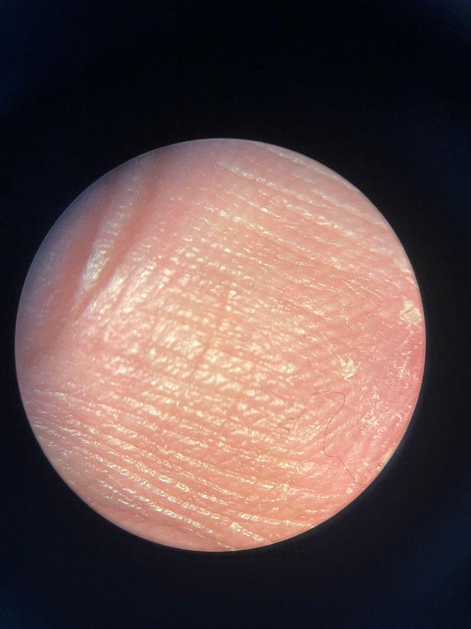 Used ZEISS S7 OPMI Movena Microscope YOM: 2009