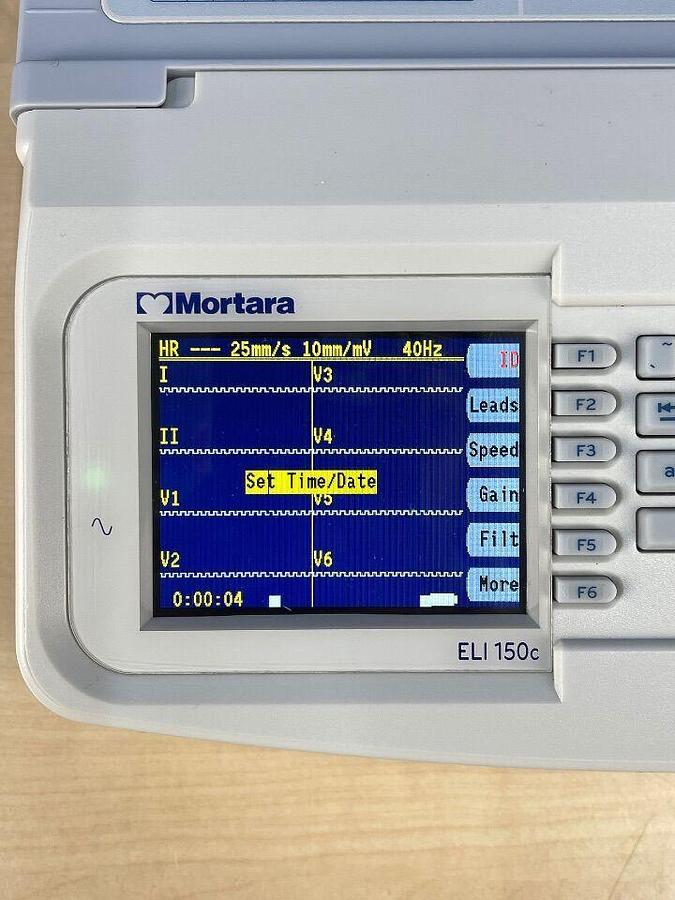 Used MORTARA ELI 150 ECG