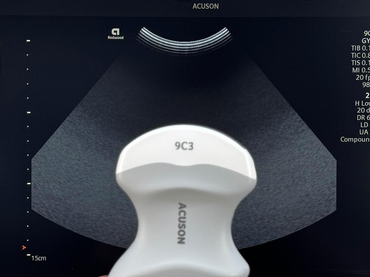 Used Siemens Acuson Redwood Diagnostic Ultrasound REF: 11503314 YOM: 2022 Probes 9C3 YOM: 2025 7VC2 YOM: 2021 9EC4 YOM: 2022