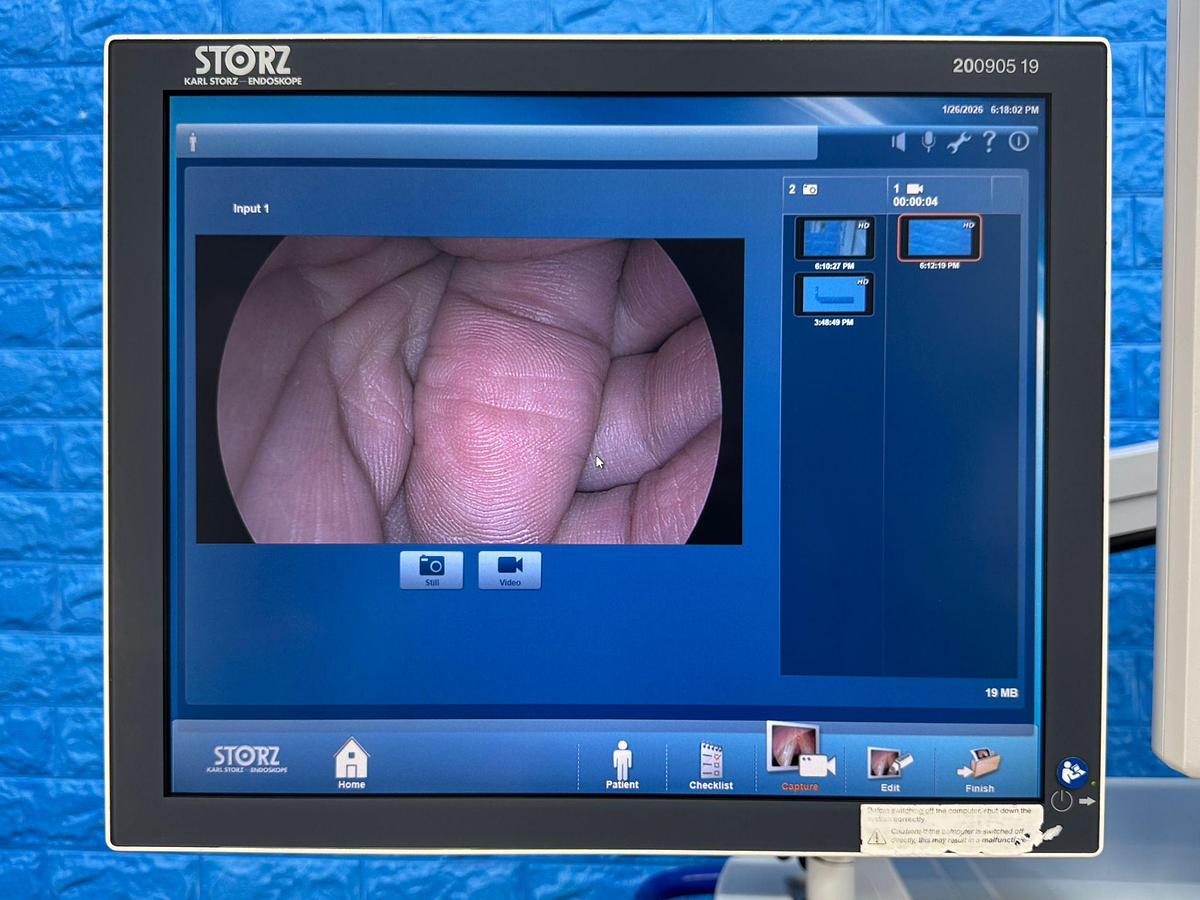 Used Karl Storz Spies Tower: -LCD Monitor 26 Inch  -Aida Monitor 19 Inch Touch Screen -Endoflator with Hose  -Keyboard -Camera Head H3-Z Spies S Full HD TH100  -Aida Control WD 200 -Xenon 300 Light source  -Spies S TC200/TC300 -Sony Printer