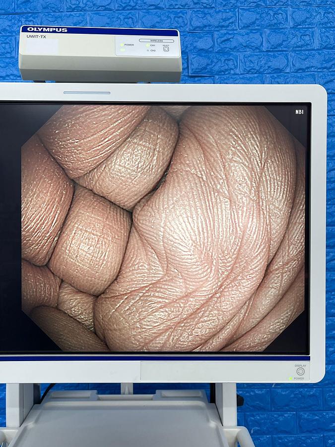 Used Olympus scope Model: GIF-HQ290