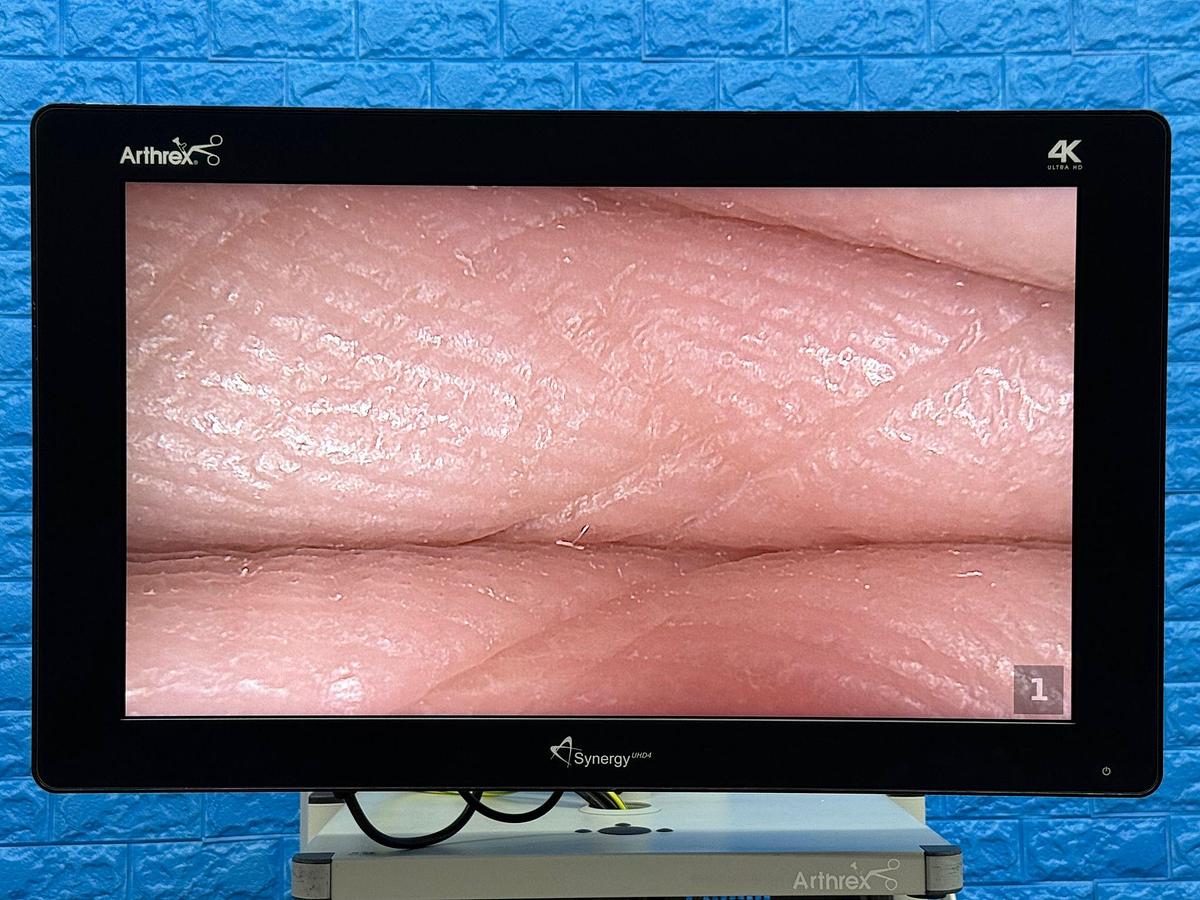 Used Arthrex 4K Laparoscopy Tower - LED 4K Monitor 32 inch YOM: 2018  - Synergy UHD4 4K Vision LED Image Processor  - Arthrex 4K Ultra Autoclave Camera Head    - Karl Storz Endoflator   - Arthrex Trolley