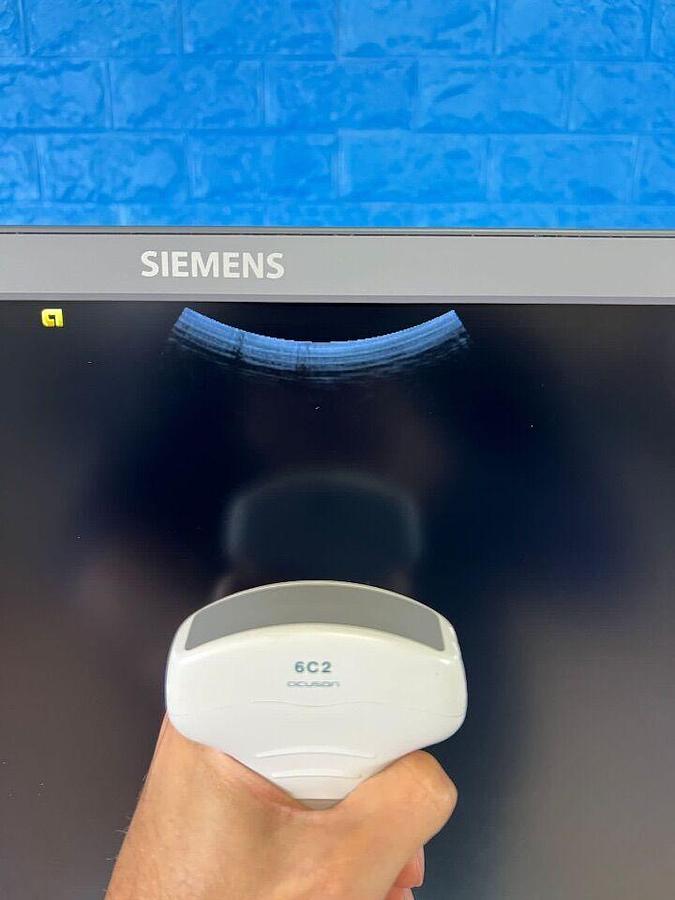 Used ACUSON/SIEMENS S1000 YOM