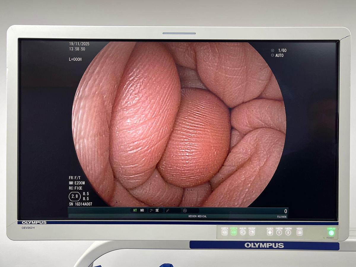 Used Fujinon Scope Model: EG-530FP Gastroscope