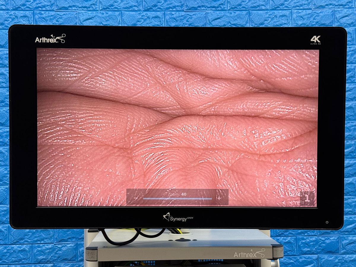 Used Arthrex 4K Laparoscopy Tower - LED 4K Monitor 32 inch YOM: 2018  - Synergy UHD4 4K Vision LED Image Processor  - Arthrex 4K Ultra Autoclave Camera Head    - Karl Storz Endoflator   - Arthrex Trolley