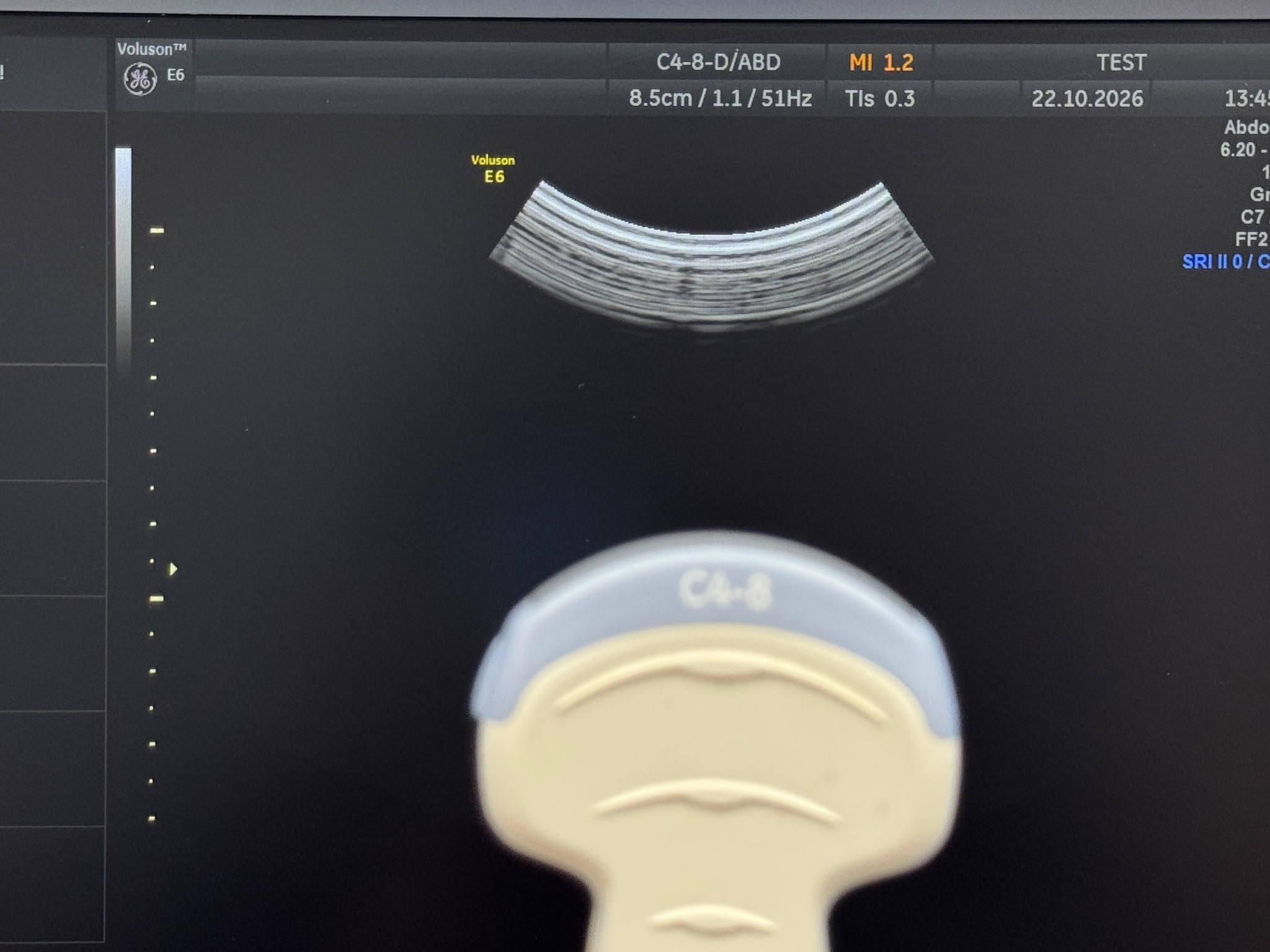 Used GE Voluson Е6 Ultrasound YOM: 2013