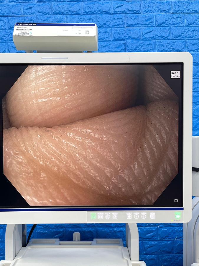 Used Olympus CV-190 with CLV-190 Endoscopy Tower 