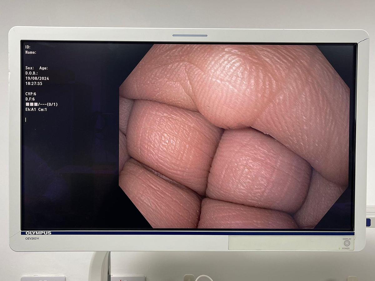 Used OLYMPUS Scope Model: GIF-HQ190 