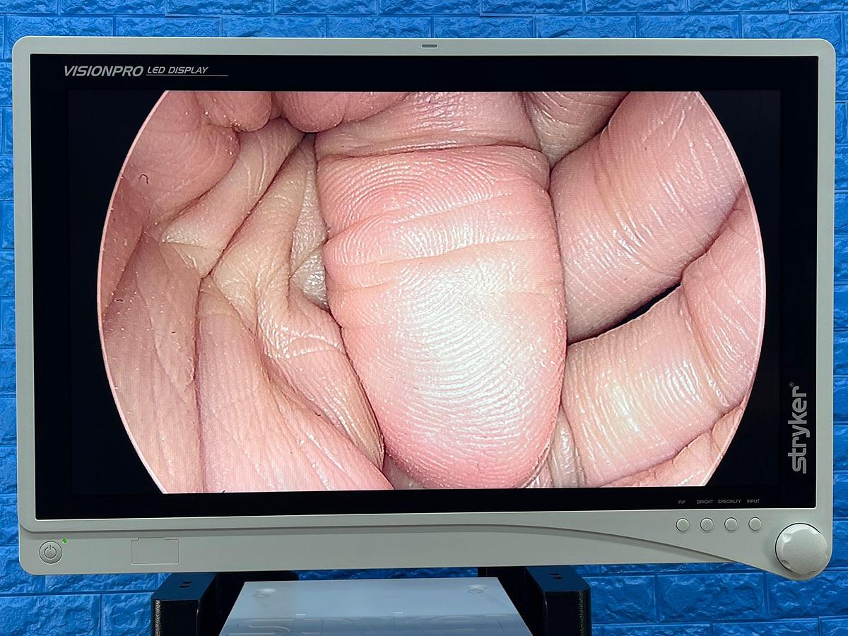 Used STRYKER 1488 Full HD Tower Laparoscope