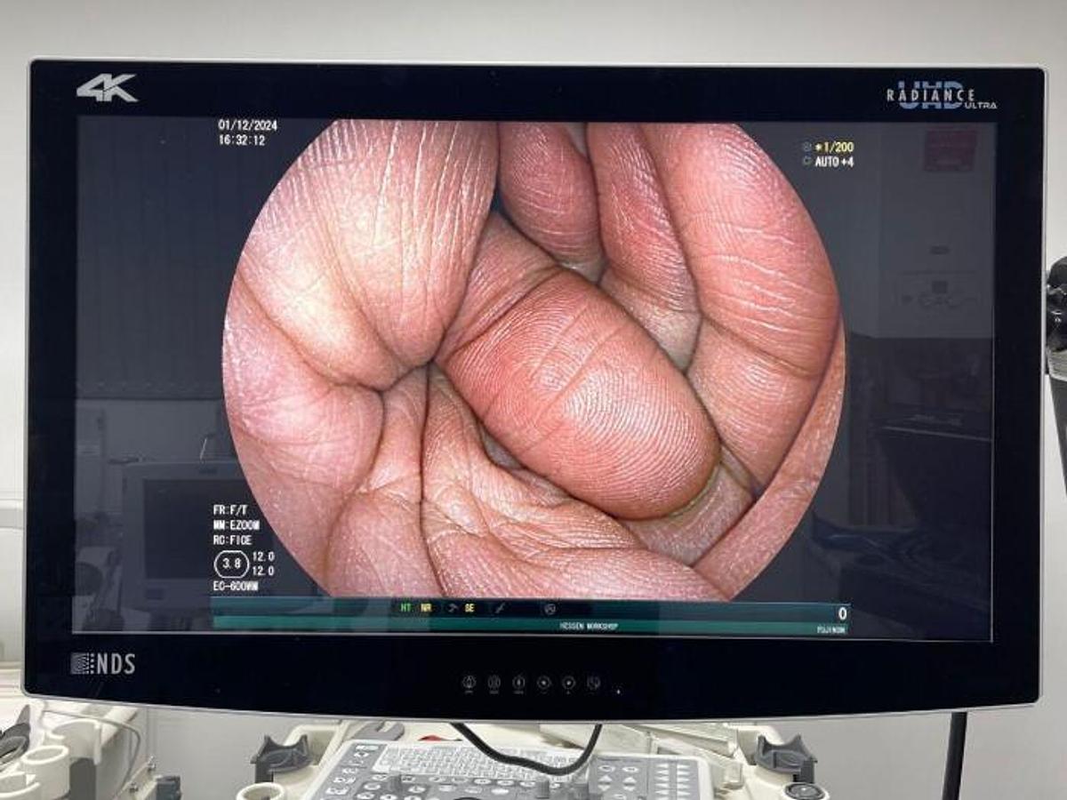 Used - FUJINON EC-600WM