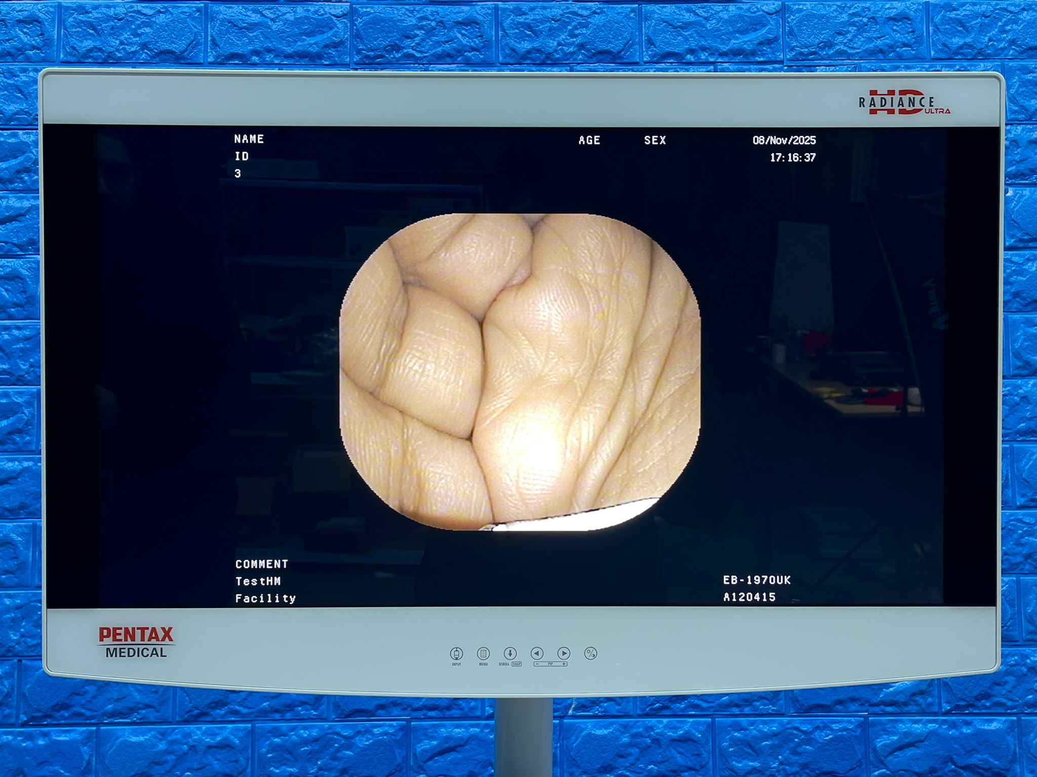 Used Pentax Scope Model: EB-1970UK Bronchoscope 