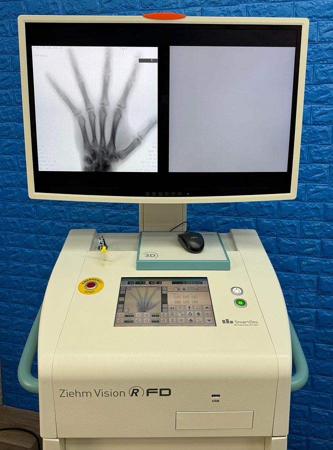 Used Ziehm Vision RFD 3D C-Arm YOM: 2020 