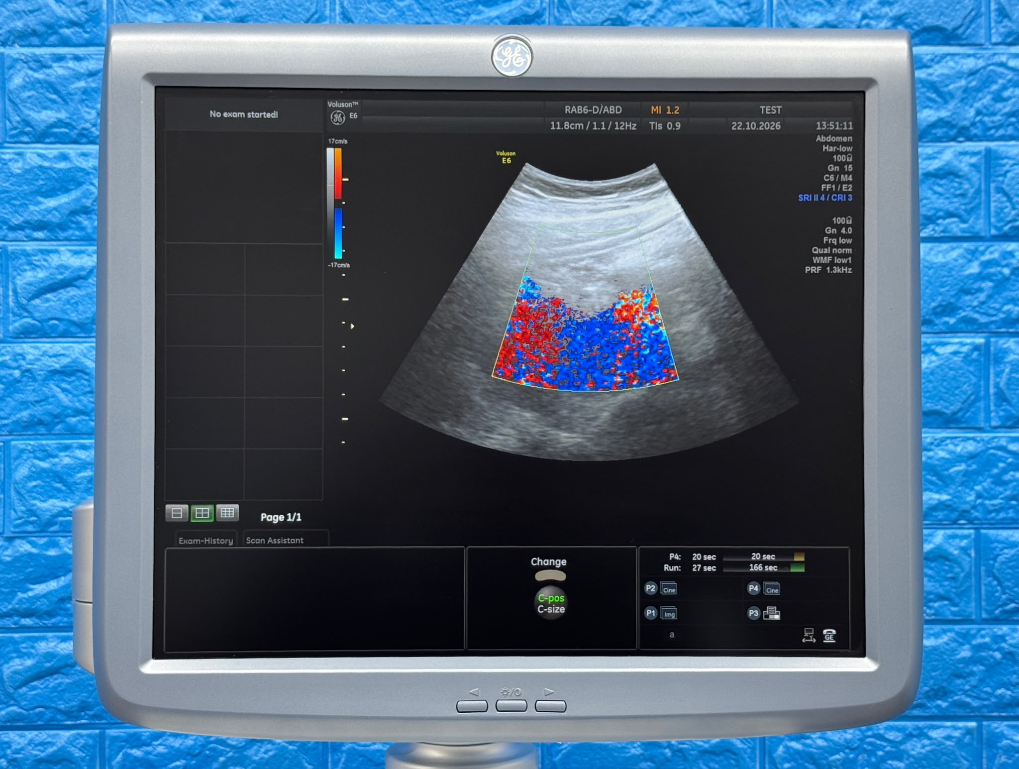 Used GE Voluson Е6 Ultrasound YOM: 2013
