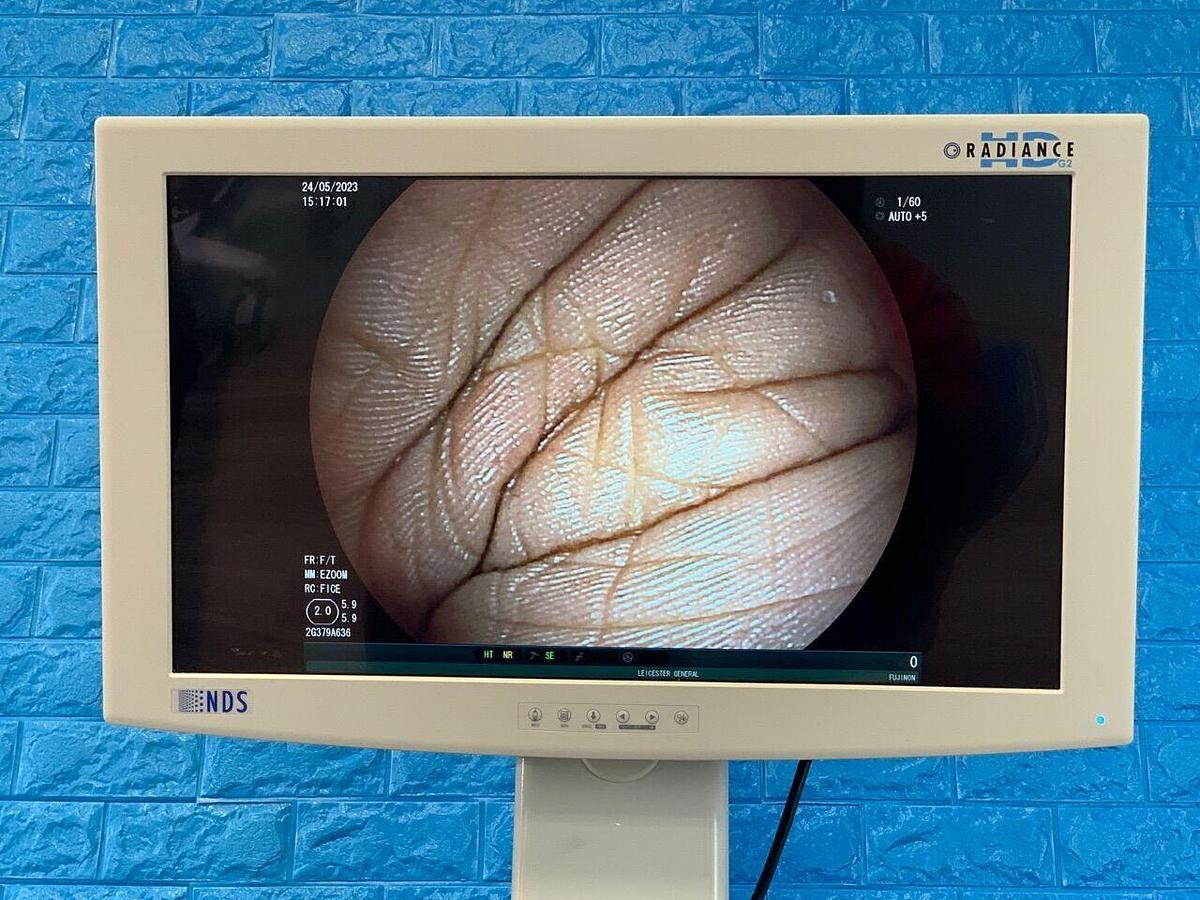 Used FUJINON EG-580NW