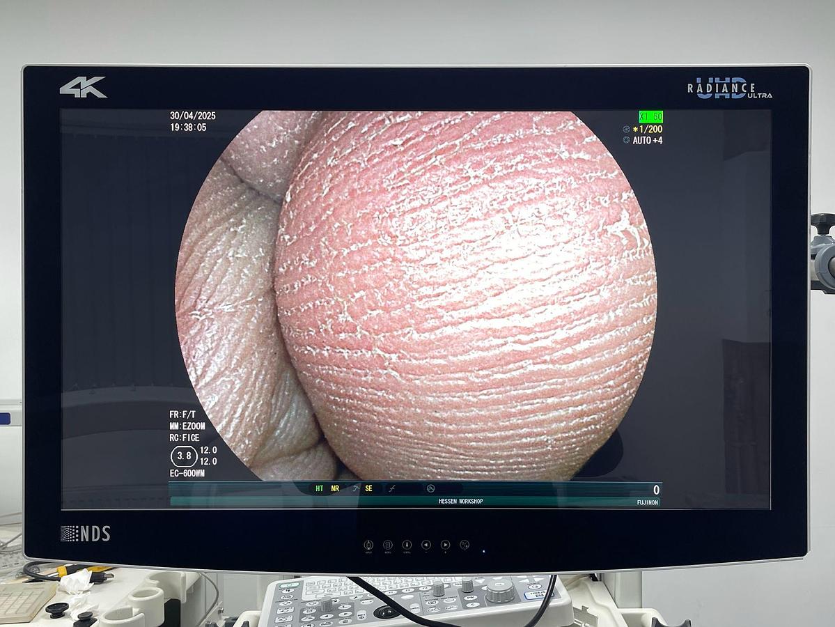 Used FUJINON Scope Model: EC-600WM Colonoscope