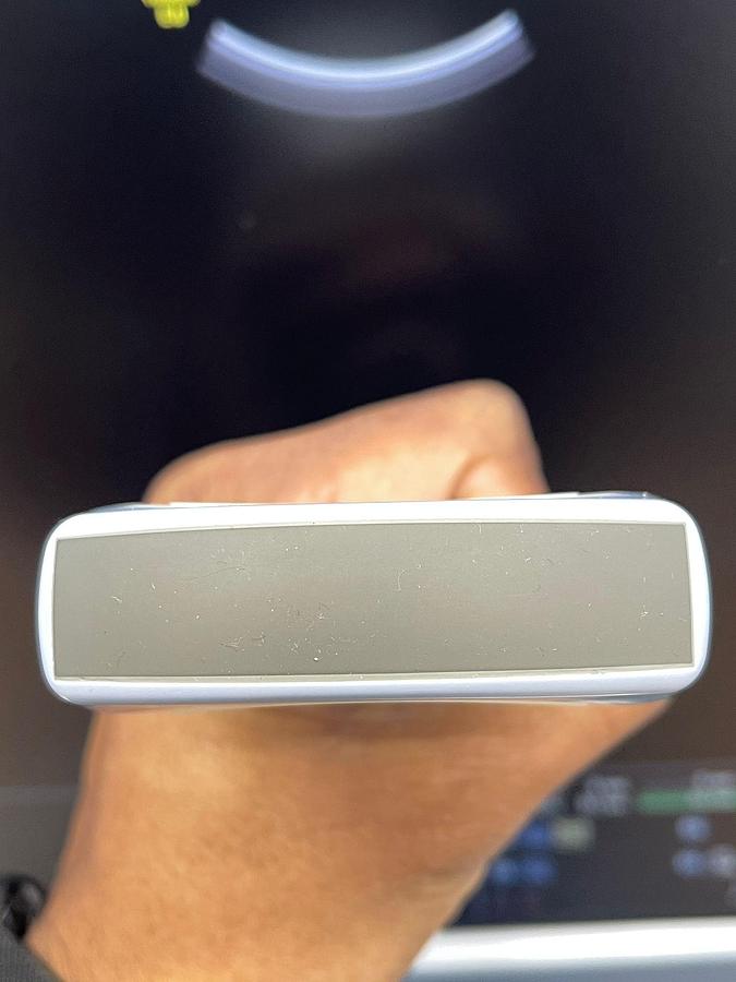 Used GE Voluson E8, YOM: 2011