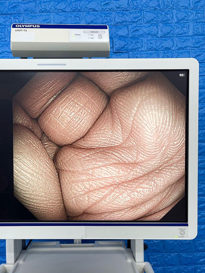 Used Olympus scope Model: GIF-HQ290