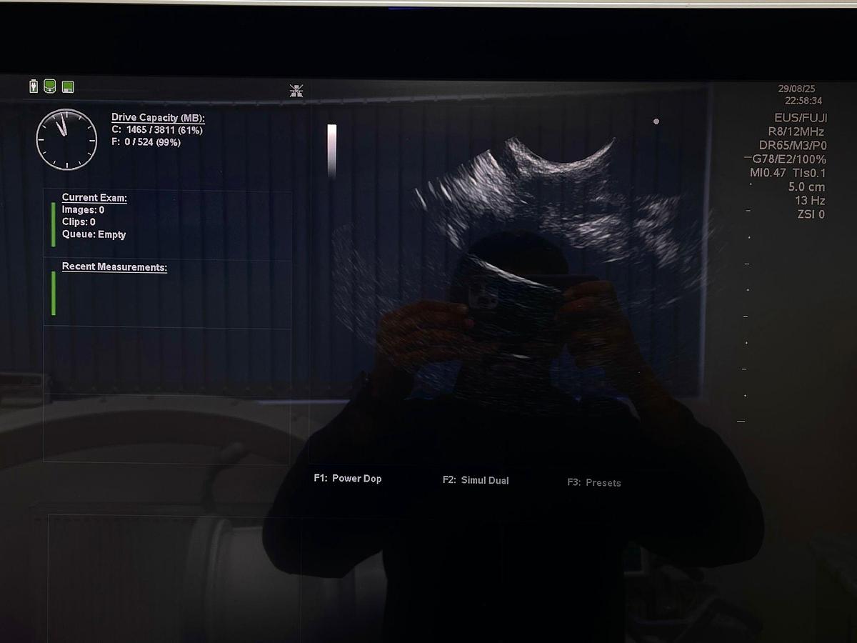 Used Fujinon Scope Model: EG-530UT YOM: 2008 