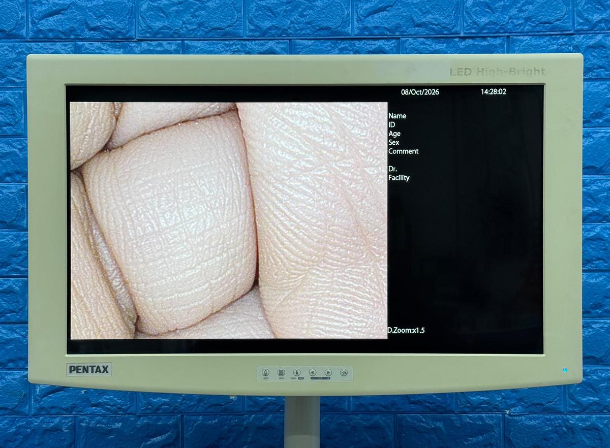Used Pentax EPK-i7000 Complete Endoscopy Tower with Gastroscope & Colonoscope YOM 2013