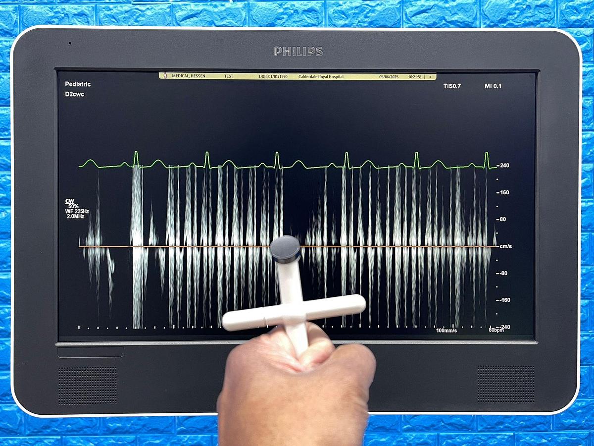 Used PHILIPS EPIQ 7C Ultrasound SW: HW B.0 YOM: 2018 Cardiac – Vascular Ultrasound