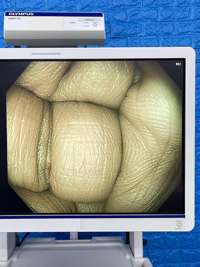 Used Olympus CF-HQ290L Colonoscope