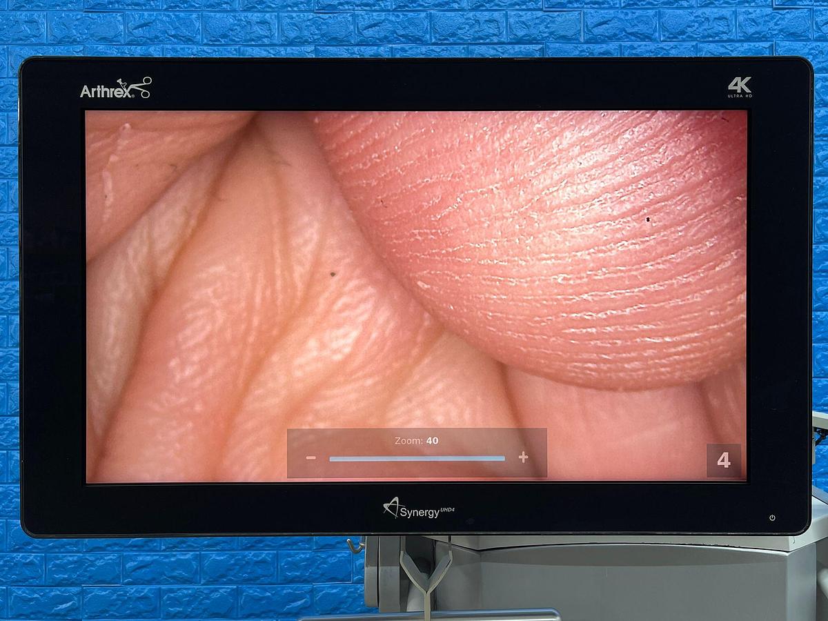 Used ARTHREX Synergy UHD4 4K Tower LED 4K Monitor 32 inch YOM: 2018