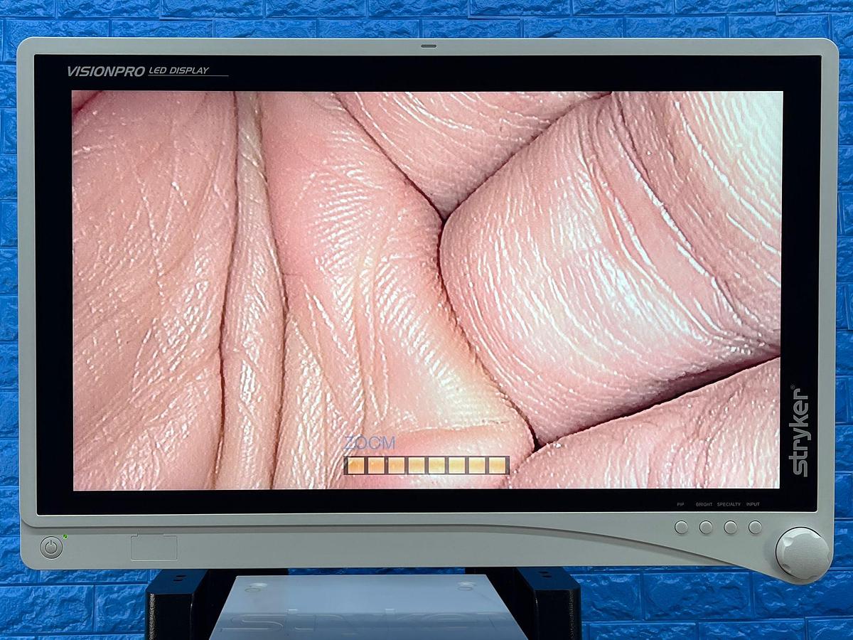 Used STRYKER 1488 Full HD Tower Laparoscope