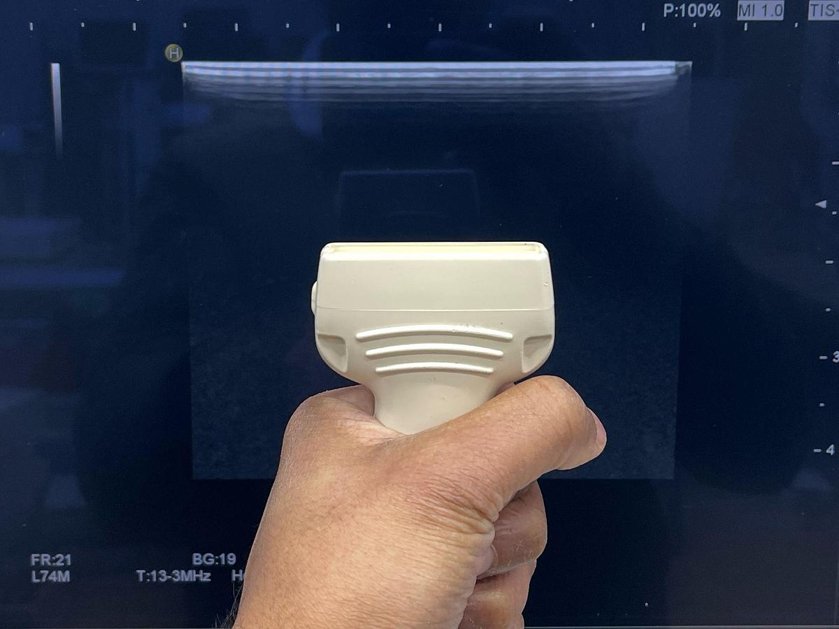 Used Hitachi HI VISION Ascendus Ultrasound YOM: 2016