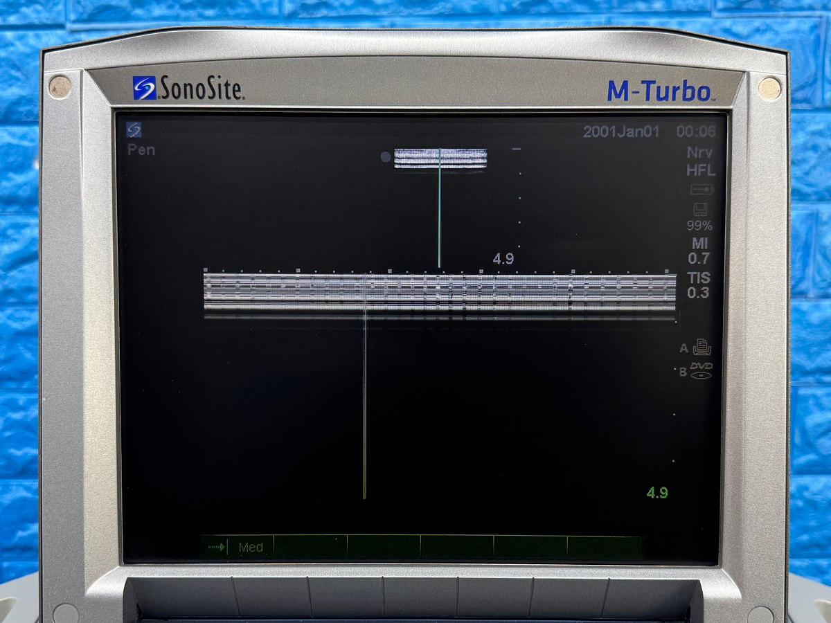 Used SonoSite Fujifilm M-Turbo Ultrasound REF: P08189-45 YOM: 2010 Probe HFL38x/13-6 MHz REF: PO7682-20 YOM: 2010