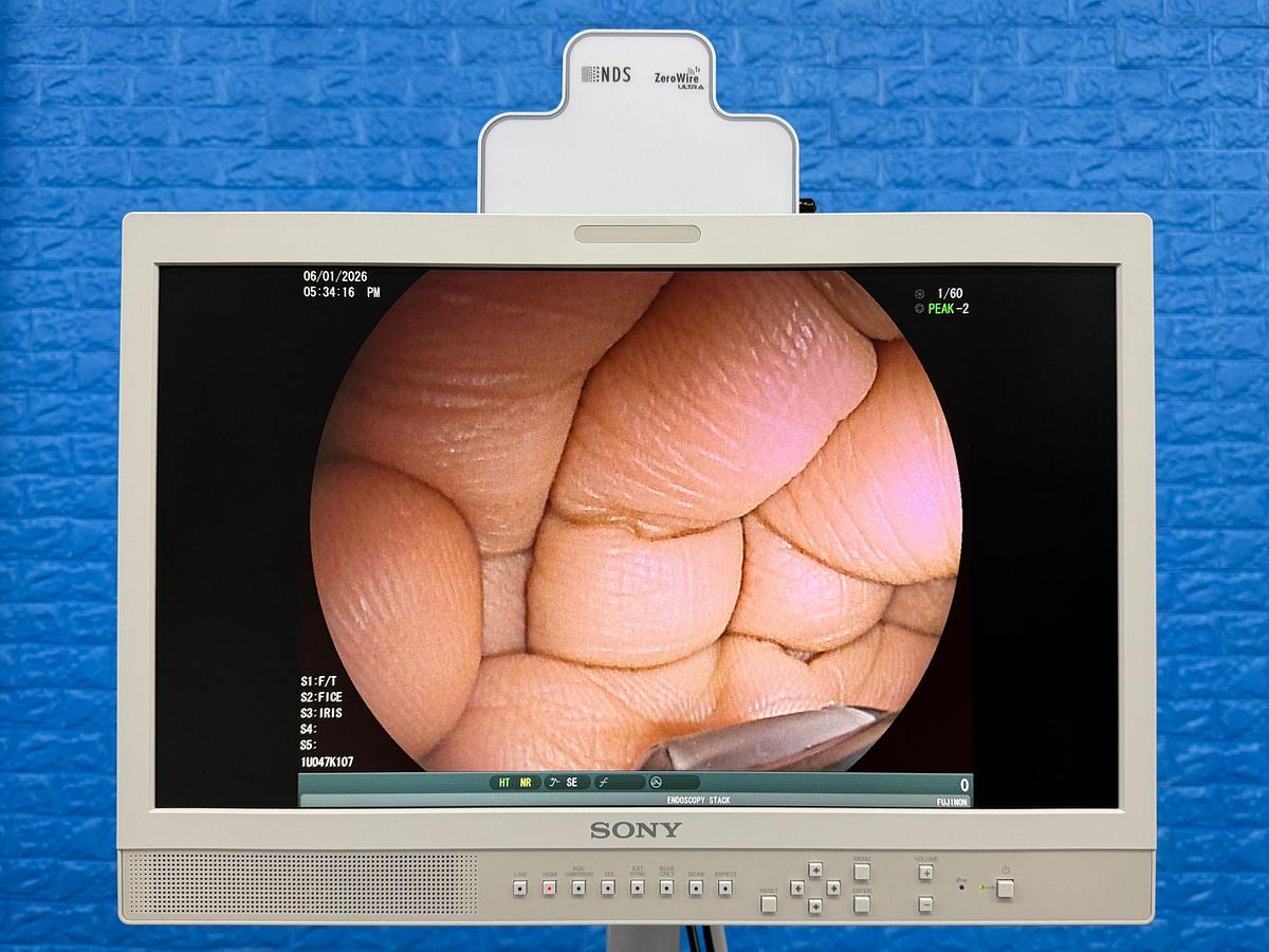 Used Fujinon Scope EG-580 UT Linear Ultrasonic Endoscope 