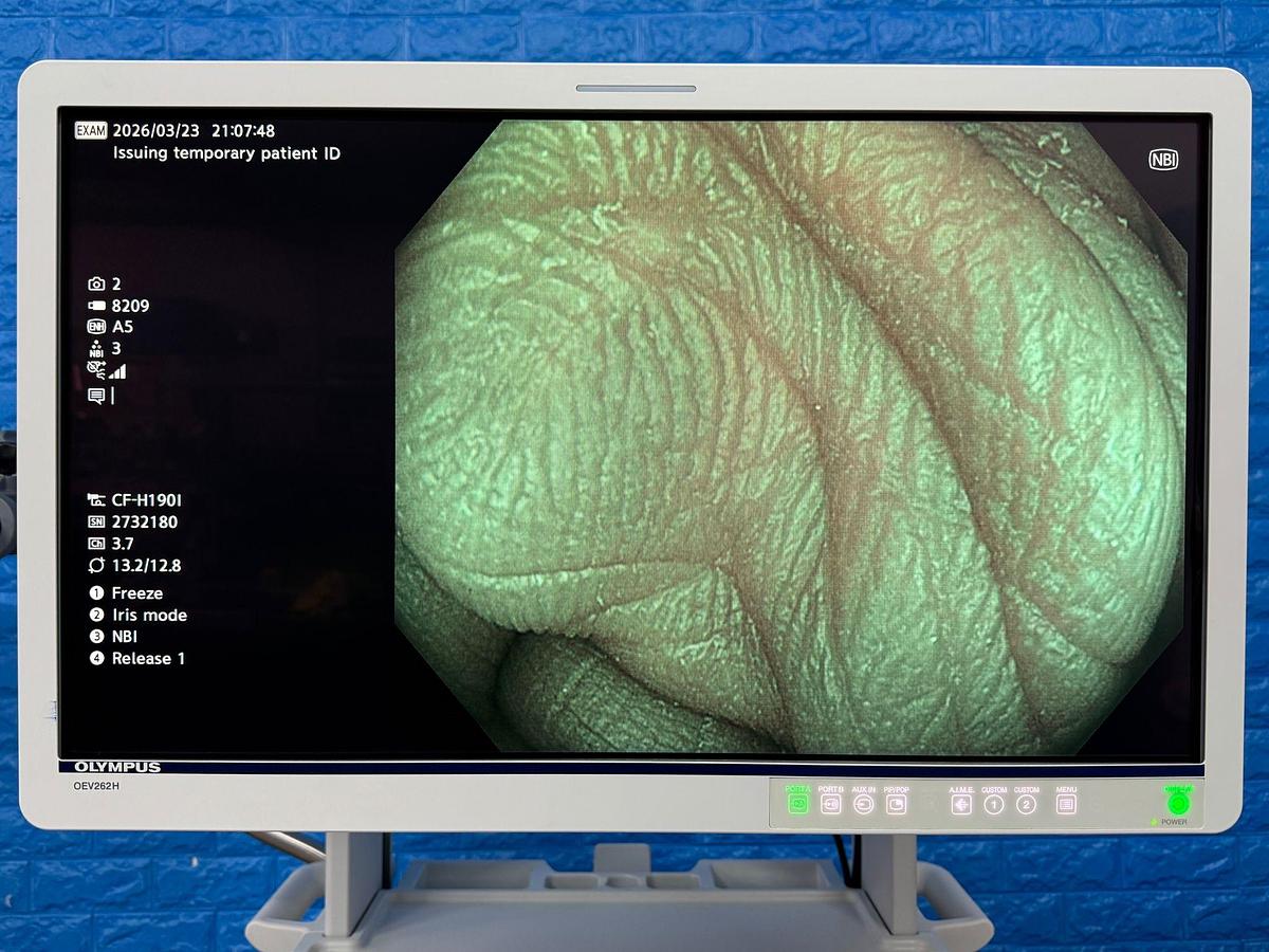 Used Olympus Scope Model: CF-H190I