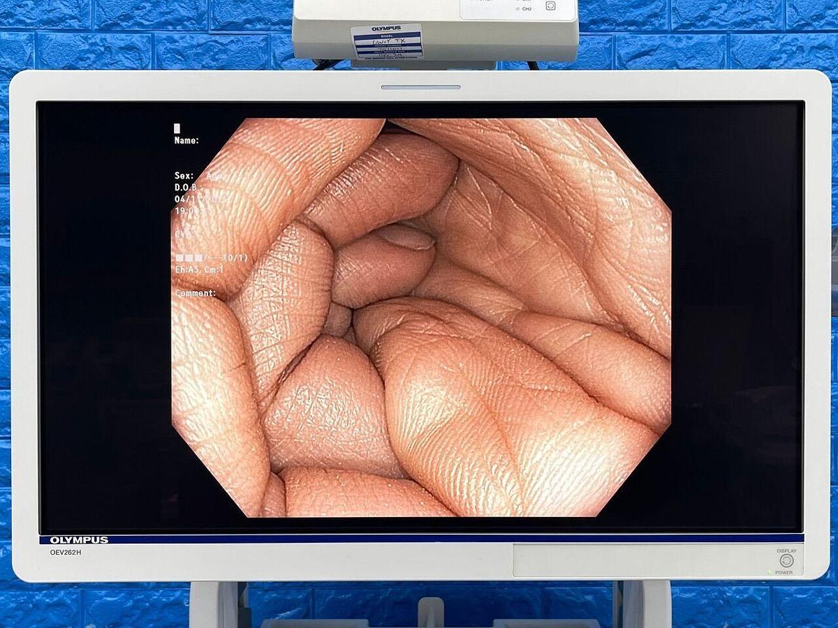 Used OLYMPUS CV-190/CLV-190 Tower Endoscope