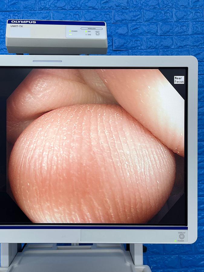 Used Olympus scope Model: CF-HQ290L 