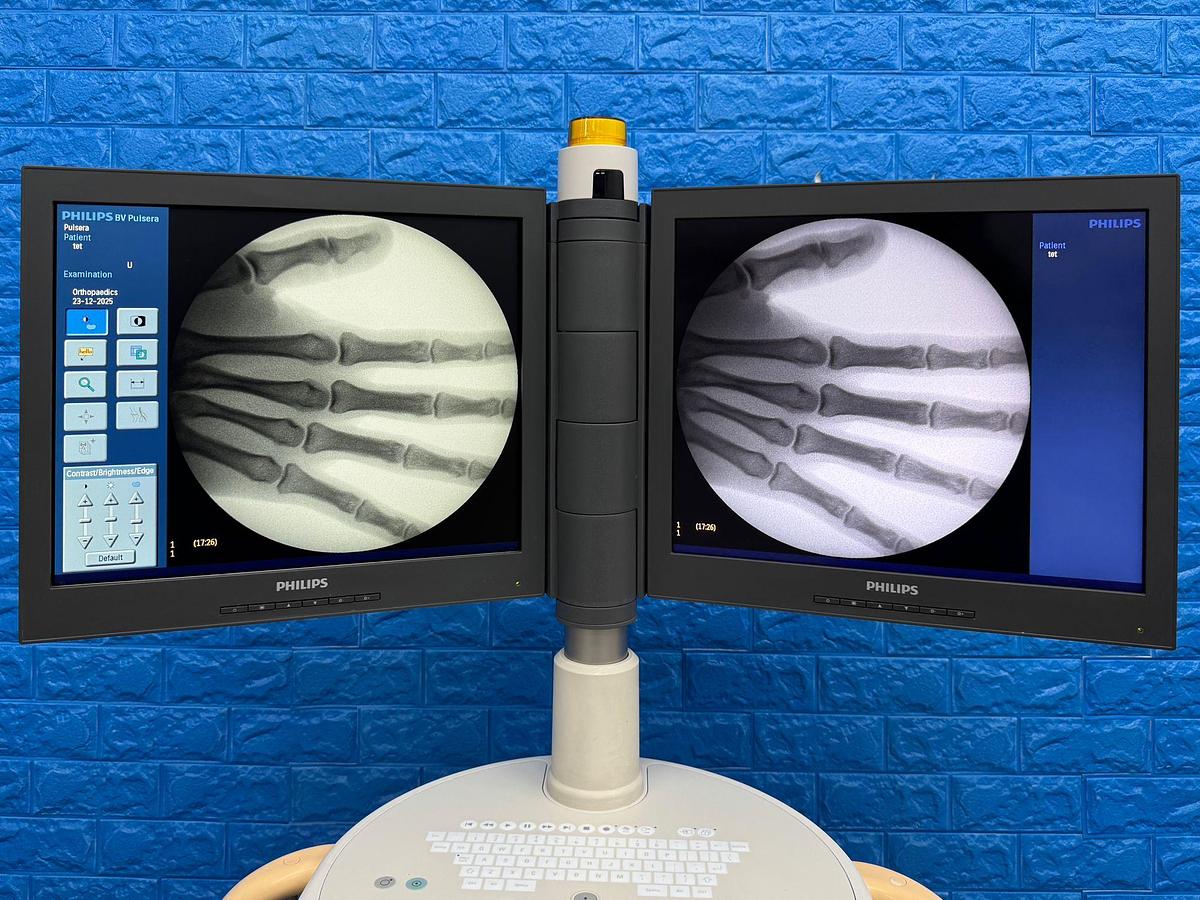 Used Philips BV PULSERA YOM: 2015 