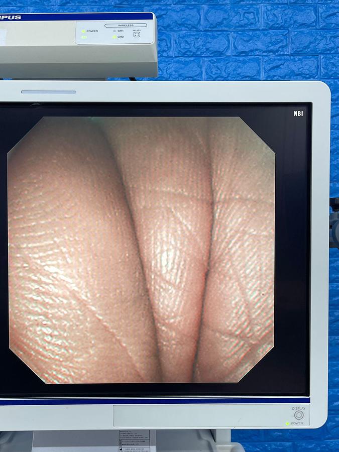 Used Olympus TJF-260V Duedenoscope