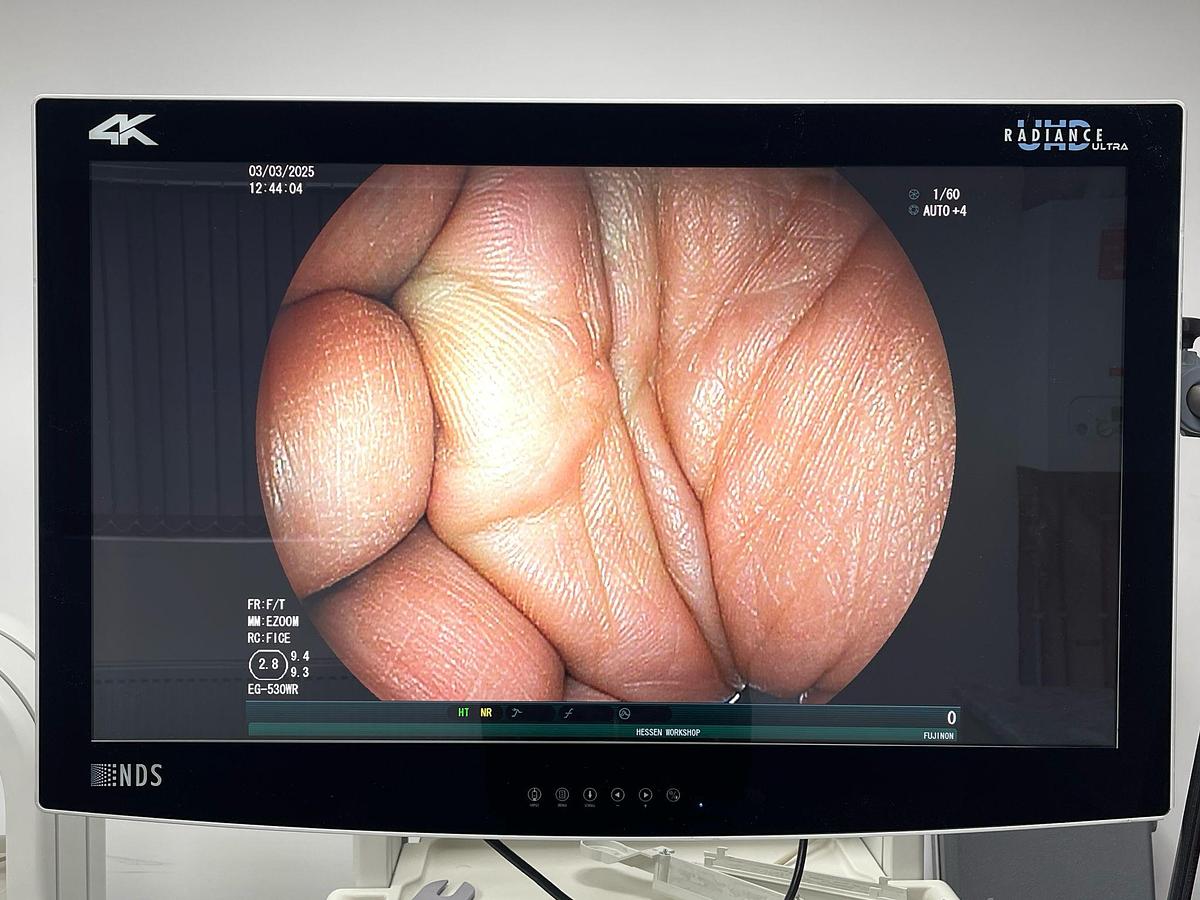 Used FUJINON Scope Model: EG-530WR