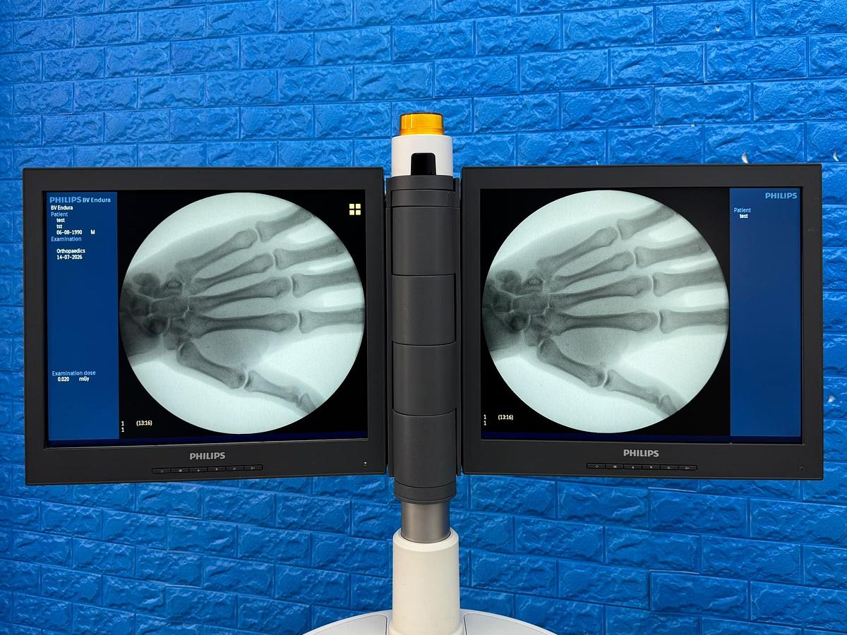 Used Philips BV Endura Software 2.5.5 YOM: 2016 SN: 001156 SN: 001492 Options: Vascular C02 Vascular Abdominal Vascular Cerebral Vascular Peripheral Abdominal Thorax Lumbar Spine Head / Spine Orthopaedics