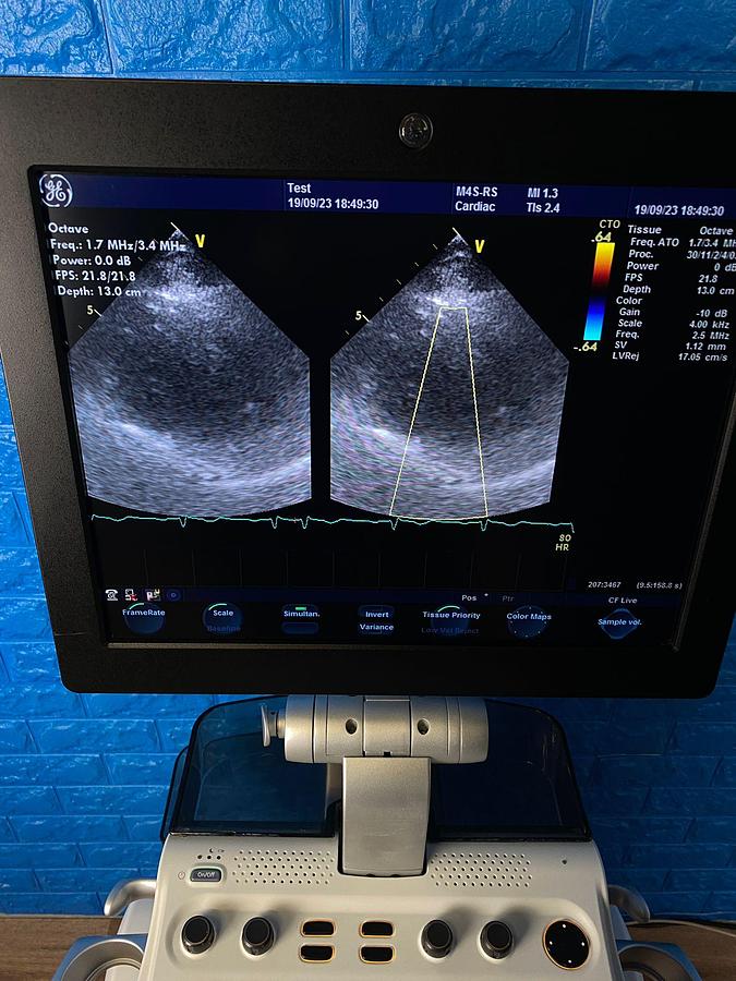 Used GE VIVID S6 YOM: 2013 Includes: M4S Cardiac Probe