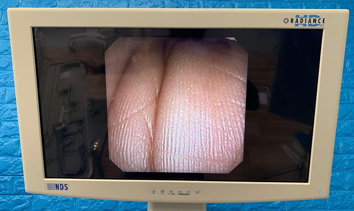 Used KARL STORZ 11292 VS 