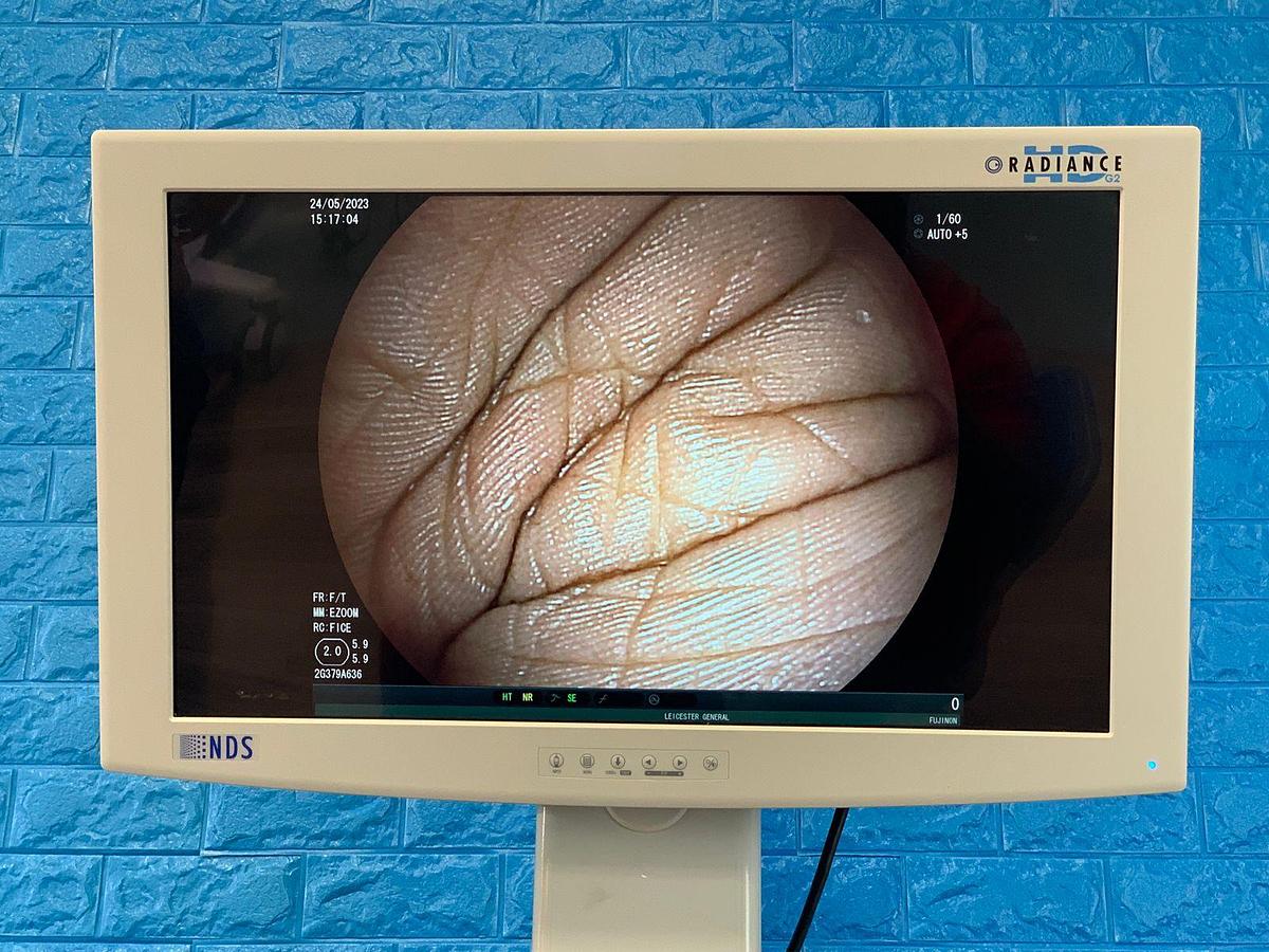 Used FUJINON EG-580NW