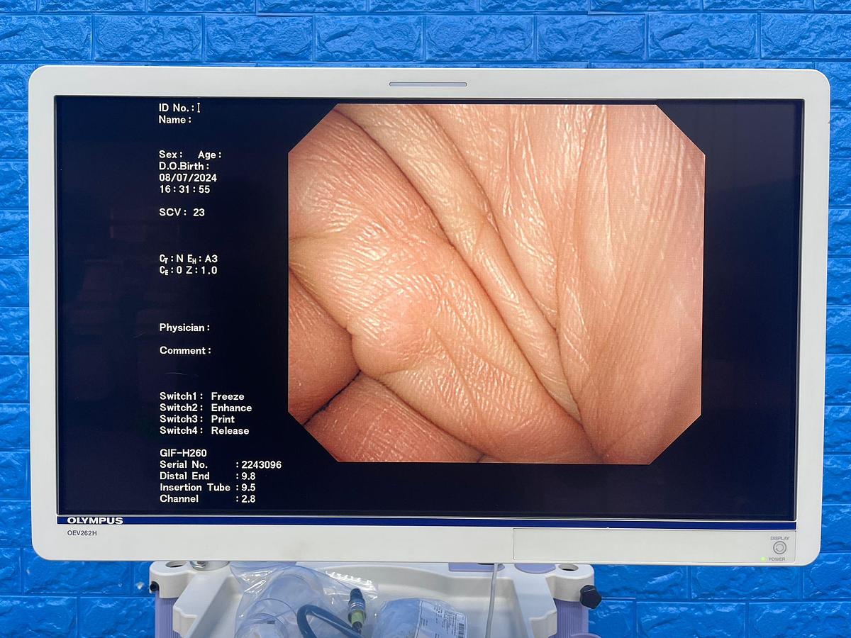 Used OLYMPUS Endoscopy Tower 260, CV-260SL Endoscope 