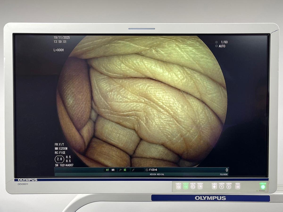 Used Fujinon Scope Model: EG-530FP Gastroscope